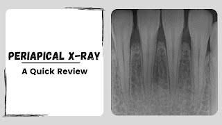 Periapical x ray  Intraoral Dental Radiograph [upl. by Icak]