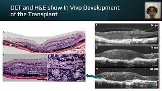 Analysis of the Development of Human Retinal Organoid Xenografts in Retinal Degenerate Rat [upl. by Renckens346]