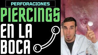 ¿USAS PIERCINGS o PERFORACIONES en la BOCA Esto te interesará [upl. by Darrel]