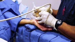 Regenexx Regenerative Orthopedic Injection Treatments of Hand Arthritis amp Injuries [upl. by Cathy]