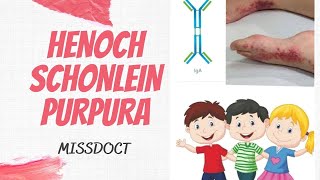 HENOCH SCHONLEIN PURPURA IgA Vasculitis [upl. by Notnroht]