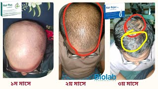 শুধু Hair Plus ৩ মাস খেতে ফলাফল দেখুন [upl. by Anid]