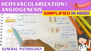 AngiogenesisNeovascularization  Pathology  Hindi [upl. by Wylen]