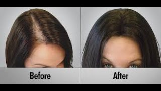 Women Hide Their Hair Loss Instantly and Permanently 559568HAIR Fresno California [upl. by Aidni]