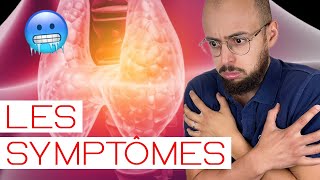 HYPOTHYROIDIE  les symptômes [upl. by Ravel819]