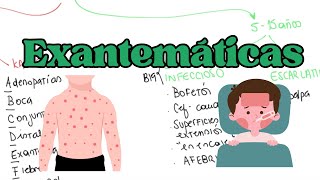 CLAVES para el DIAGNOSTICO DIFERENCIAL de las EXANTEMÁTICAS en PEDIATRÍA [upl. by Yendyc]