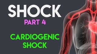 Cardiogenic Shock  Shock Part 4 [upl. by Urquhart]