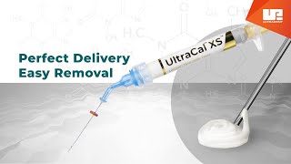 UltraCal™ XS Overview  Delivery and Removal [upl. by Raf]