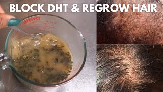 Natural DHT Blockers to fight Alopecia and Regrow Hair Protective Style [upl. by Lontson]