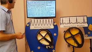 Ventriküler Taşikardi  Ventricular Tachycardia with maquette [upl. by Rahal]