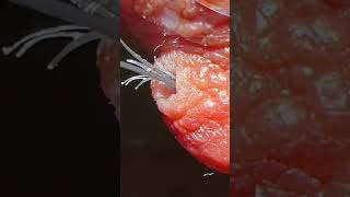 Top 3 Compilation Ingrown hair removal [upl. by Gaynor661]