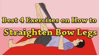 Best 4 Exercises on How to Straighten Bow Legs [upl. by Aitnyc]