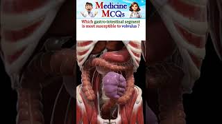 Digestive System  Colonic Volvulus  Test your medical knowledge  MCQs [upl. by Lole]