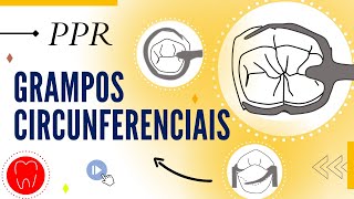 RETENTORES DIRETOS  GRAMPOS CIRCUNFERENCIAIS [upl. by Ahsoet]