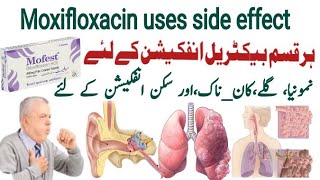 moxifloxacin 400 mg uses in urdu moxifloxacin 400 mg  Mofest 400mg  X gen 400mg  Avelox 400mg [upl. by Eddie]