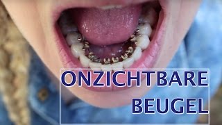 Onzichtbare beugel strakker zetten  FURROWNL [upl. by Attenborough]