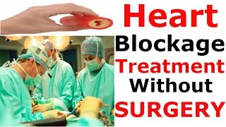 Heart blockage treatment without surgery  Natural Home Remdies As Medicine For ANGIOPLASTY [upl. by Widera]