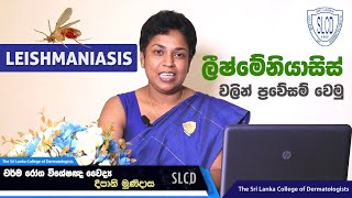 Leishmaniasis ලීෂ්මේනියාසිස්  වැලි මැස්සාගෙන් බෝවන රෝග  Dr Deepani Munidasa skincare [upl. by Nairbal]