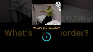 What’s the disorder neurology [upl. by Ised]