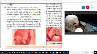 Limiting structures of maxillary arch Part 2 [upl. by Enytsuj]