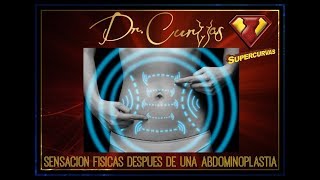 Abdominoplastia  Proceso de cicatrización [upl. by Bendix]