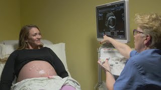 Ultrasounds during pregnancy [upl. by Alitta684]