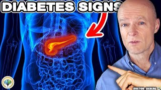 10 Warnings Signs Of DIABETES A Week BEFORE It Happens [upl. by Brentt]