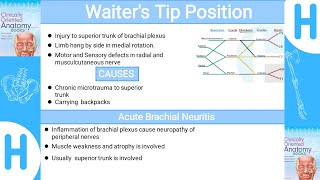 Waiter s Tip Position  Upper limb clinicals  brief explanation [upl. by Gonzalo]