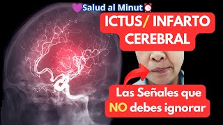 ICTUS  INFARTO CEREBRAL amp Las señales que NO debes ignorar [upl. by Ellehcear84]