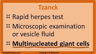 Herpes Mono HSV Chickenpox Shingles EBV CMV Cold Sore VZV Varicella [upl. by Robers]