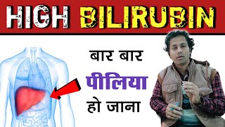 क्या उच्च बिलीरुबिन ठीक हो सकता है  HIgh Bilirubin  High sgpt  sgot  dr tarun [upl. by Abehs]