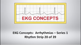 EKG Concepts Arrhythmias Course  Strip 20 of 39 [upl. by Circosta]