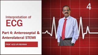 ECG Part 4 Anteroseptal amp Anterolateral STEMI final [upl. by Millford344]