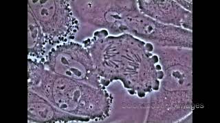 Mitosis in an animal cell Under the Microscope [upl. by Grosmark812]