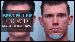 Using Dermal Fillers To Create a Masculine Jaw at Mabrie Facial Institute [upl. by Jillane420]