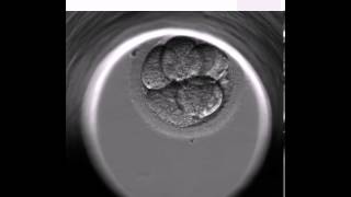 BONITO EMBARAZO CON EMBRYOSCOPE [upl. by Anuaf100]