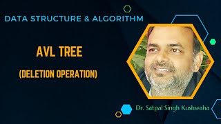 AVL Tree Deletion Operation [upl. by Niret617]