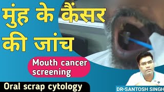 Mouth Cancer test Scrap cytology  Oral Cancer Screening Test Explained in Hindi [upl. by Rolo]