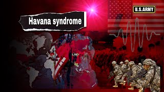 Havana Syndrome  A mysterious disease [upl. by Icrad385]