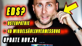 Meine 4D Wirbelsäulenvermessung  Aktueller OsteopathiePlan Ehlers Danlos Syndrome als HF Ursache [upl. by Constantin713]