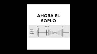 ESTENOSIS MITRAL SOPLO Así se escucha cardiology cardio [upl. by Lovich]