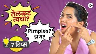 Acne Spot Removal  Oily Skin Moisturizer  Pimples Treatment at Home  Acne Scars Urmila Nimbalkar [upl. by Delmer]