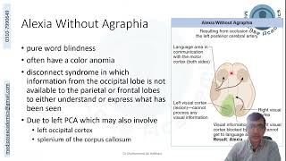 Cerebral Dominance amp Disconnect Syndromes [upl. by Adiazteb681]