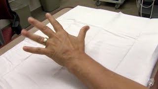 Mayo Clinic Minute What may be causing your hands and feet to tingle [upl. by Noiwtna]