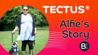 Tectus ® Case Study Alfie Wright Paralympic ParaPowerlifter [upl. by Aeresed]