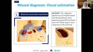 Advancing PPH management using the calibrated drapes amp a bundled approach of care [upl. by Riker]