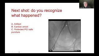 Ischemia club webinar 27032024 [upl. by Debbie662]