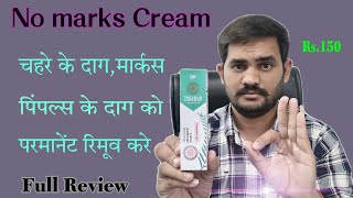 nomarks cream use review benefits in hindinomarks cream ke fayde [upl. by Linis339]