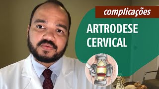 Complicações da Artrodese Cervical  CAGE [upl. by Pattison494]