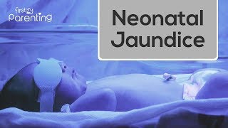 Neonatal Jaundice  Causes Symptoms and Treatment [upl. by Schellens956]